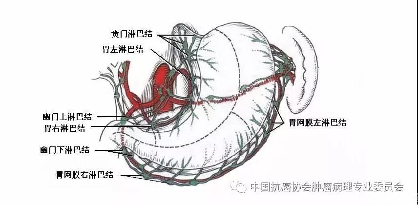 图4 胃淋巴结分组