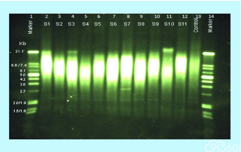 文献精选丨wb/southern blot/northern blot,为啥没有