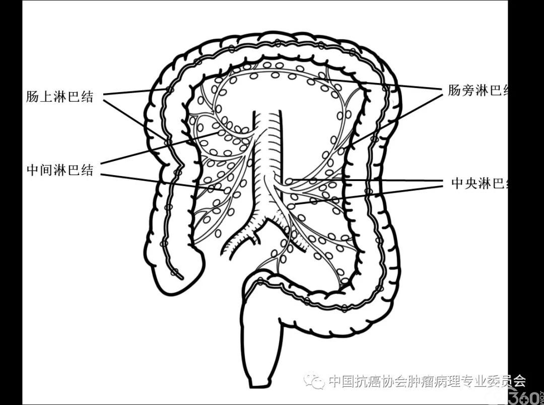 结直肠区域淋巴结取材示意图