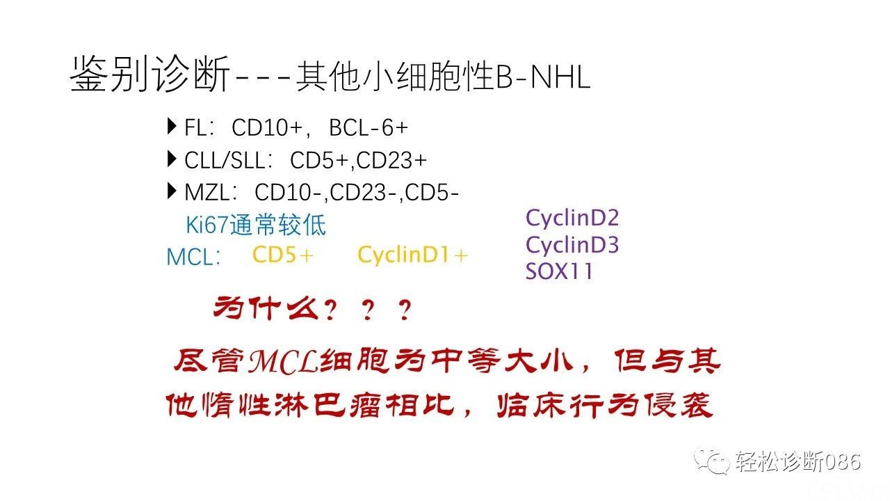 典型淋巴瘤病例分享一例