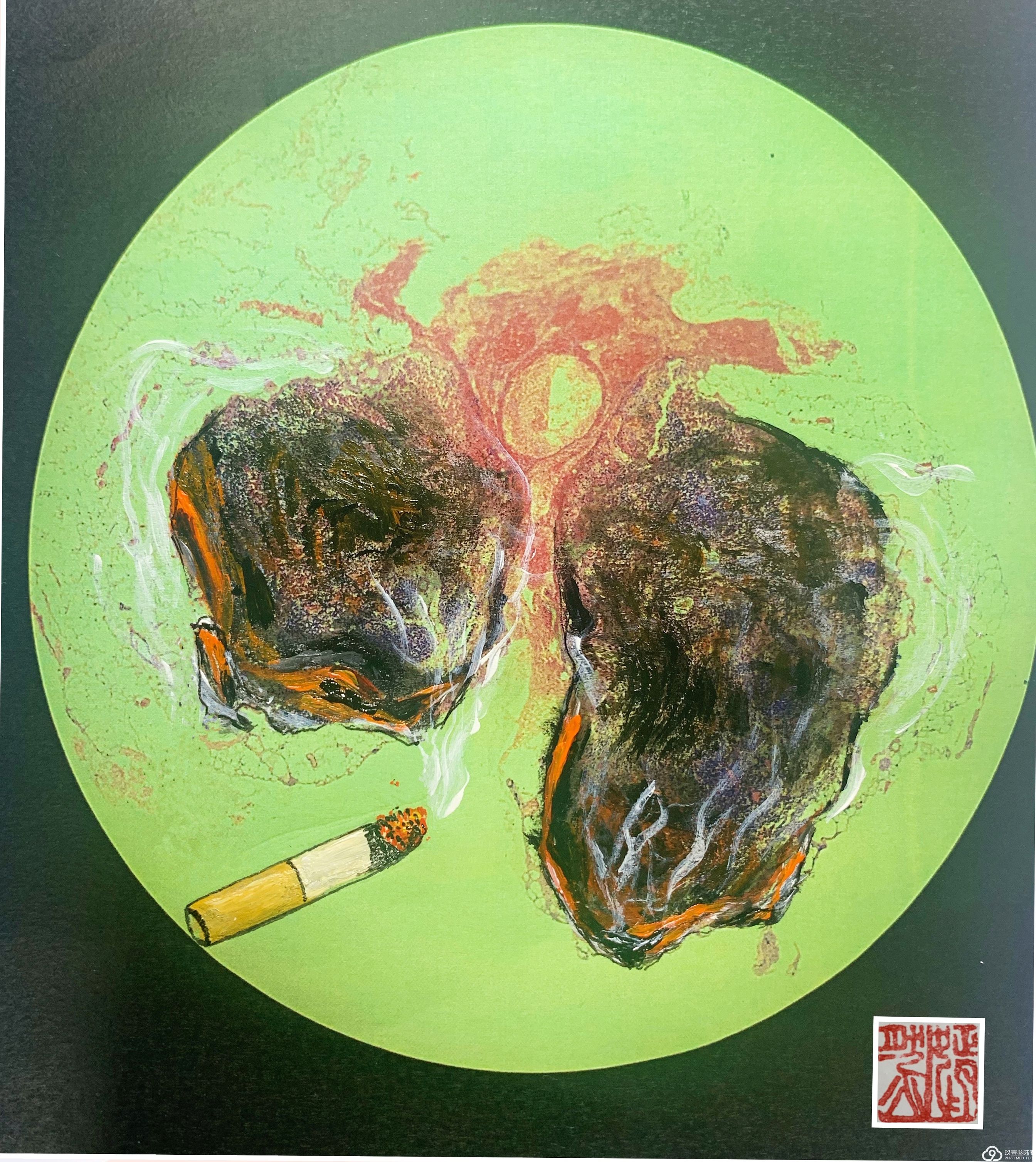 手绘病理世界——《吸烟有害健康》