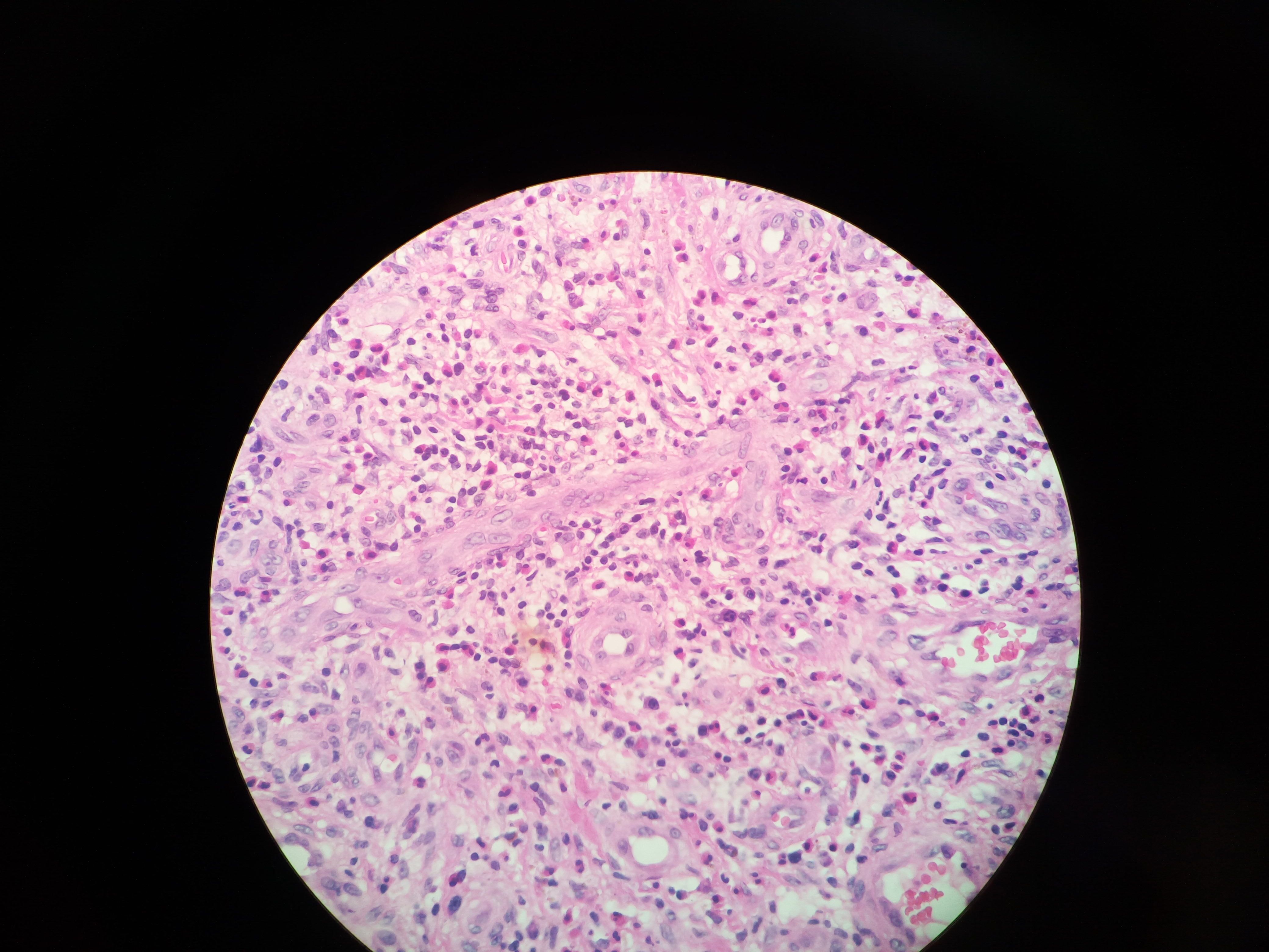 男19 头皮 - 头颈部病理 - 91360病理论坛