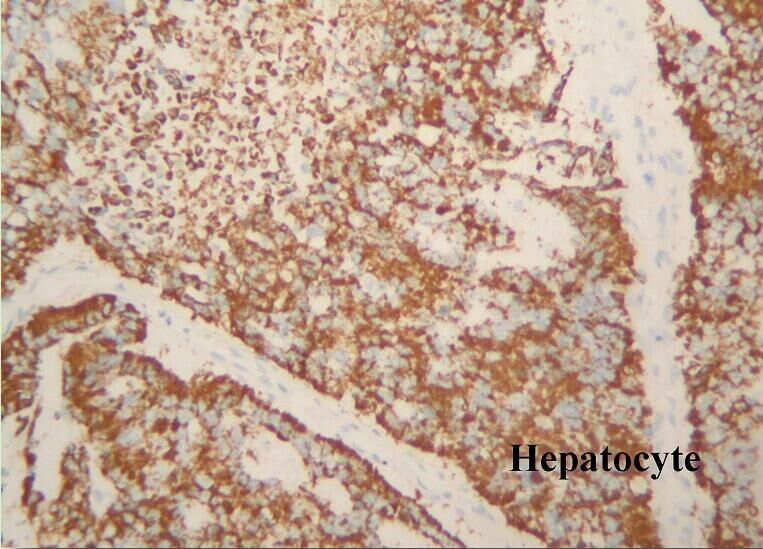 Hepatocyte.jpg