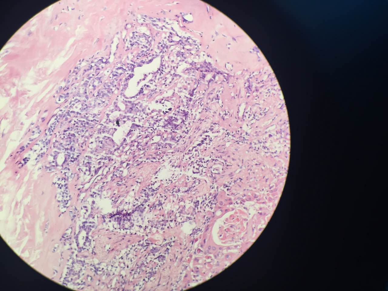 皮肤表面的人类乳头瘤病毒照片摄影图片_ID:132801973-Veer图库