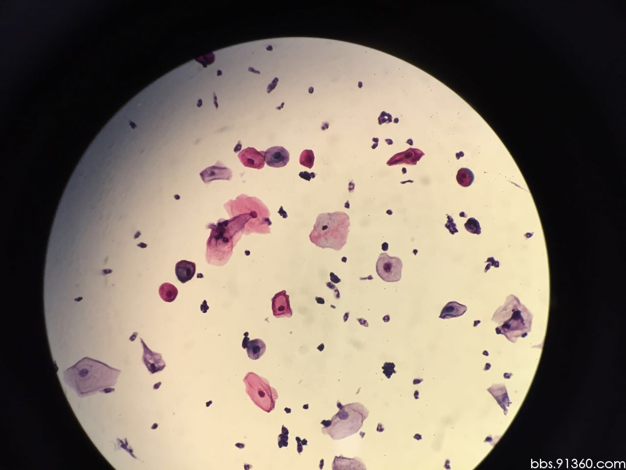 中底层细胞的量化2016.4.21【91360细胞沙龙案例42】