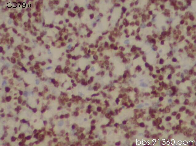 CD79α