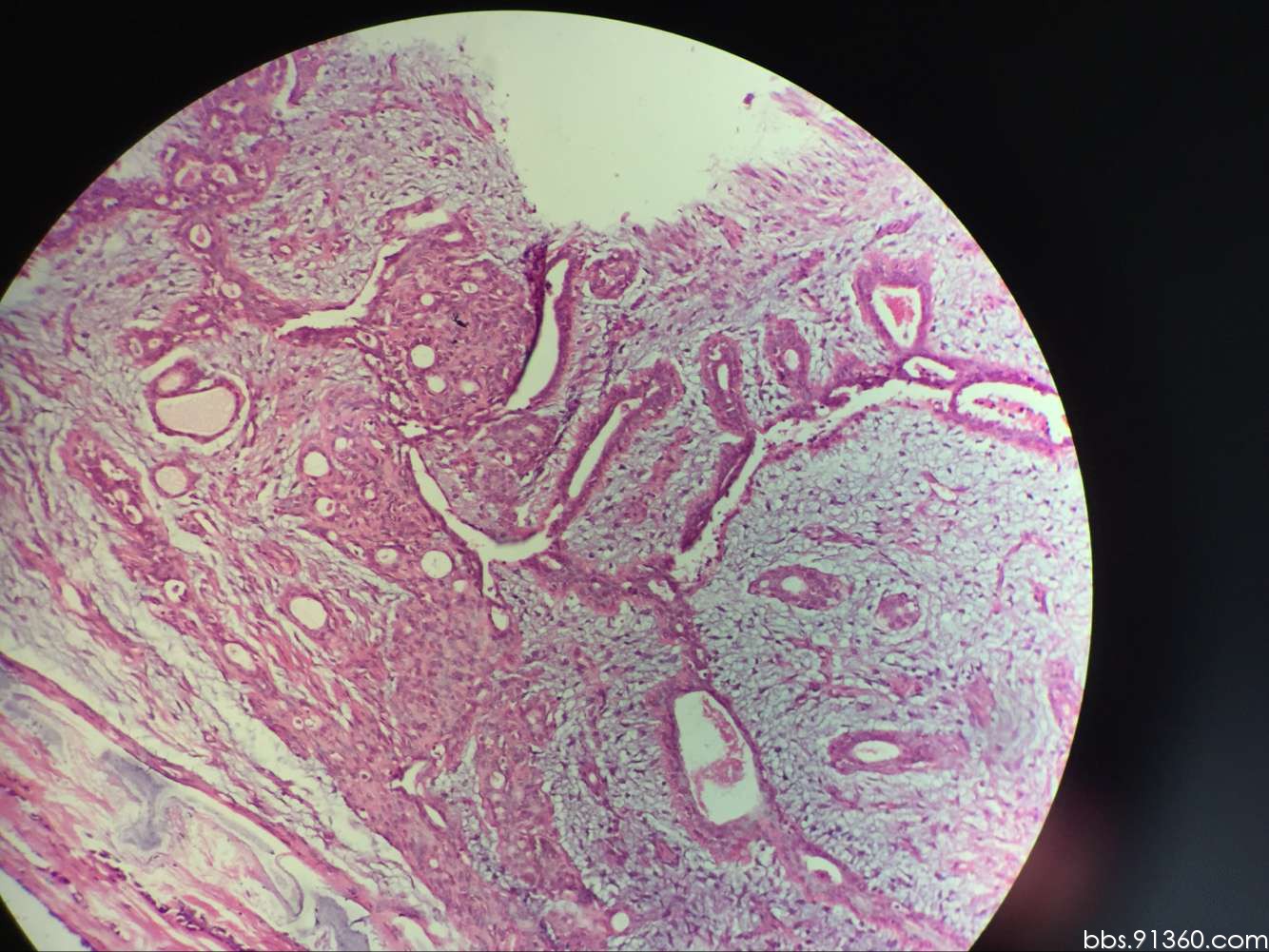 图13～23 妊娠期乳腺(光镜结构)-功能组织学与胚胎学-医学