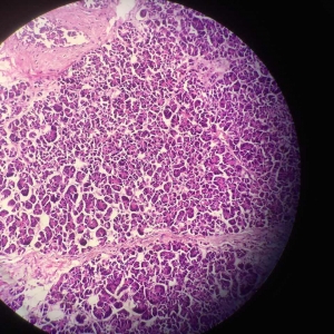 胰腺腺泡细胞图片
