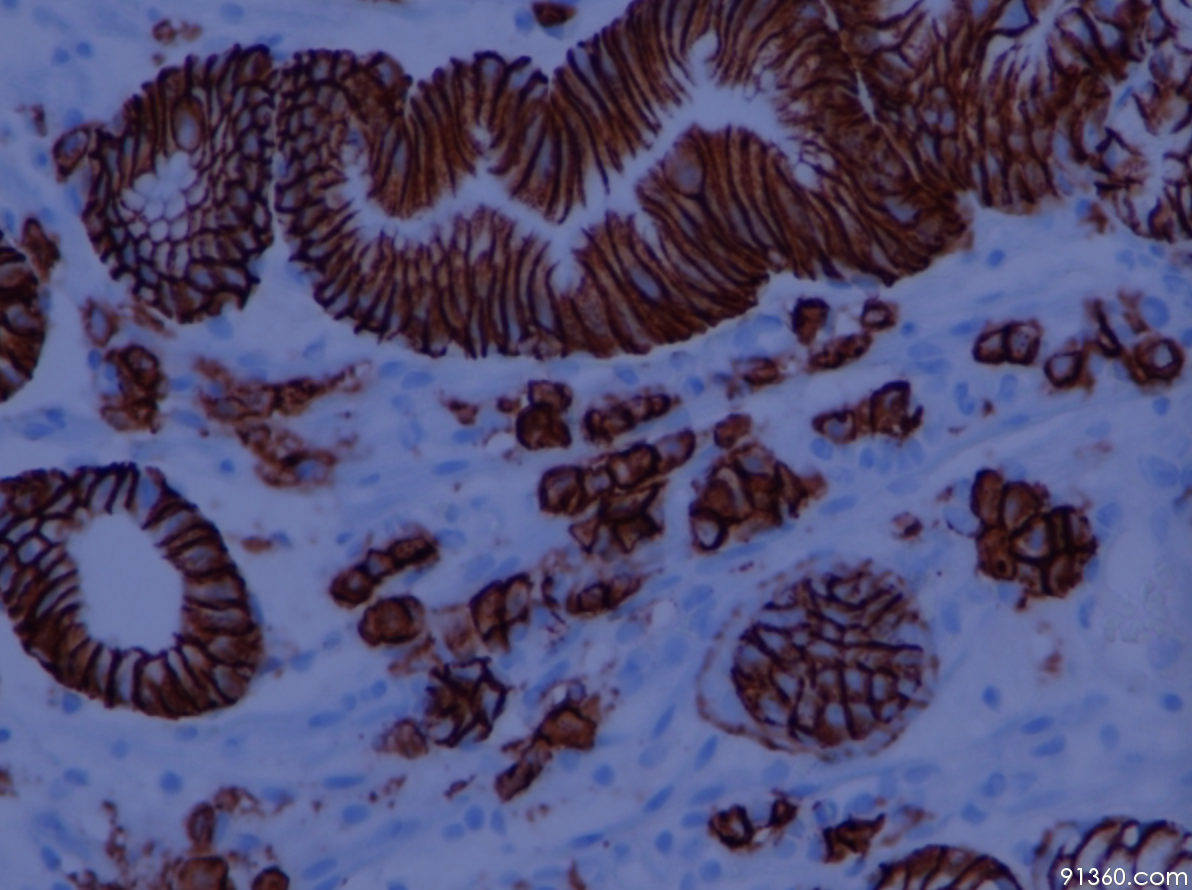 胃体浆细胞光镜图图片