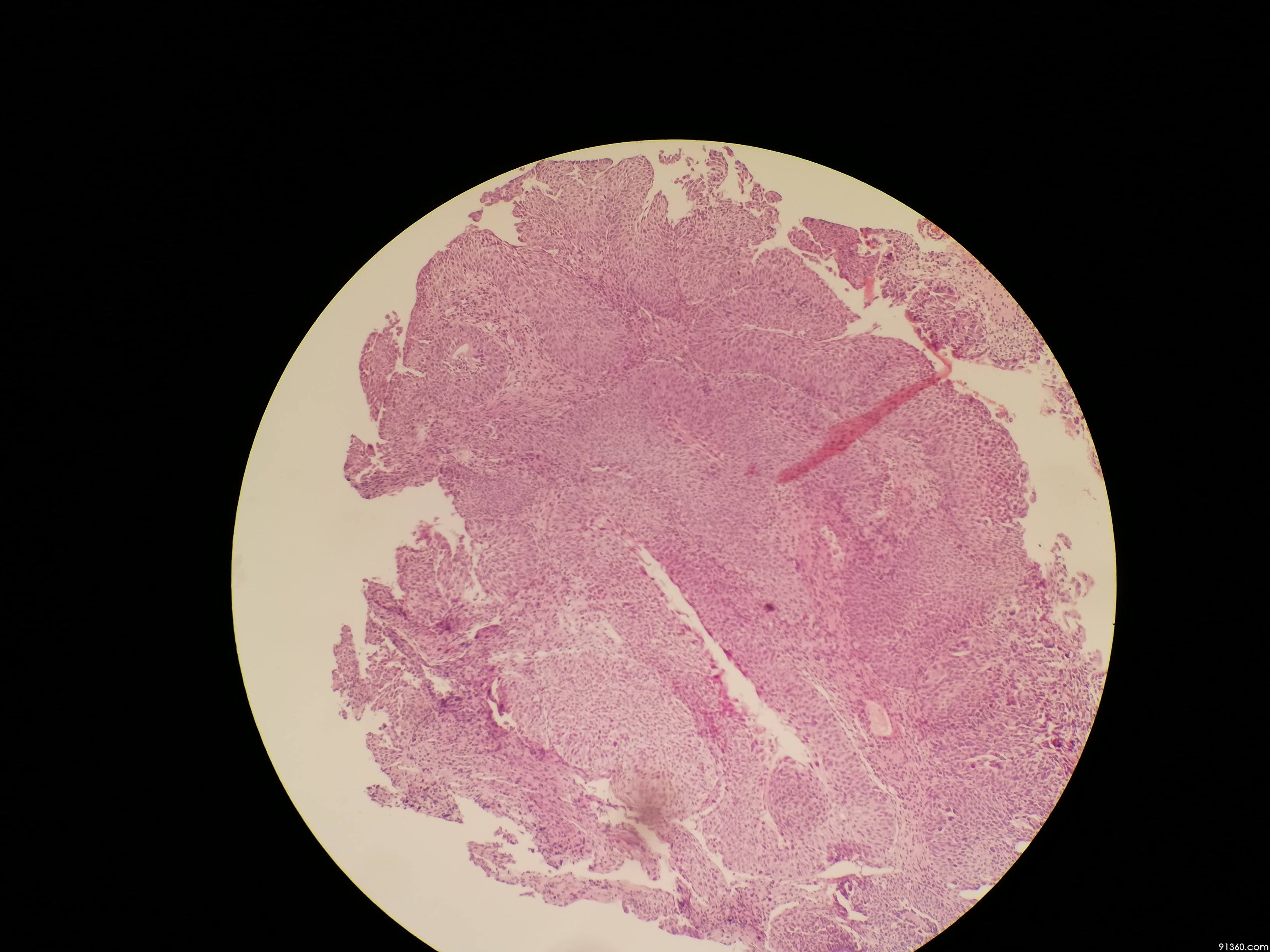 膀胱组织切片结构图片