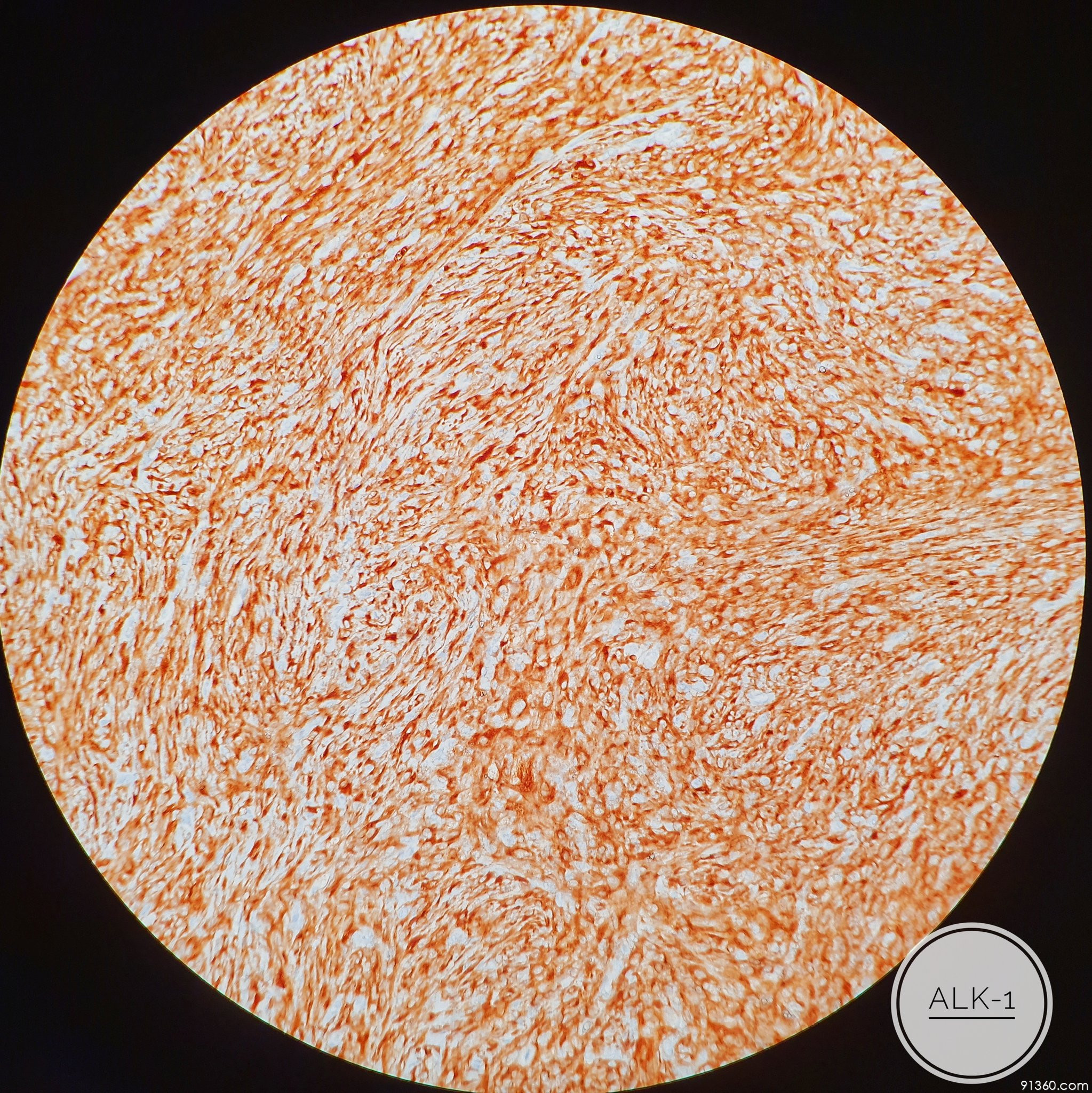 纤维母细胞镜下图片图片