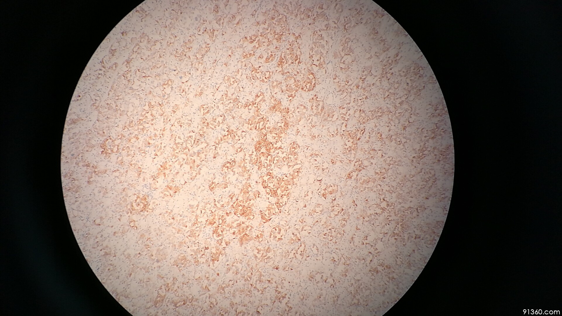 腺垂体嫌色细胞图片