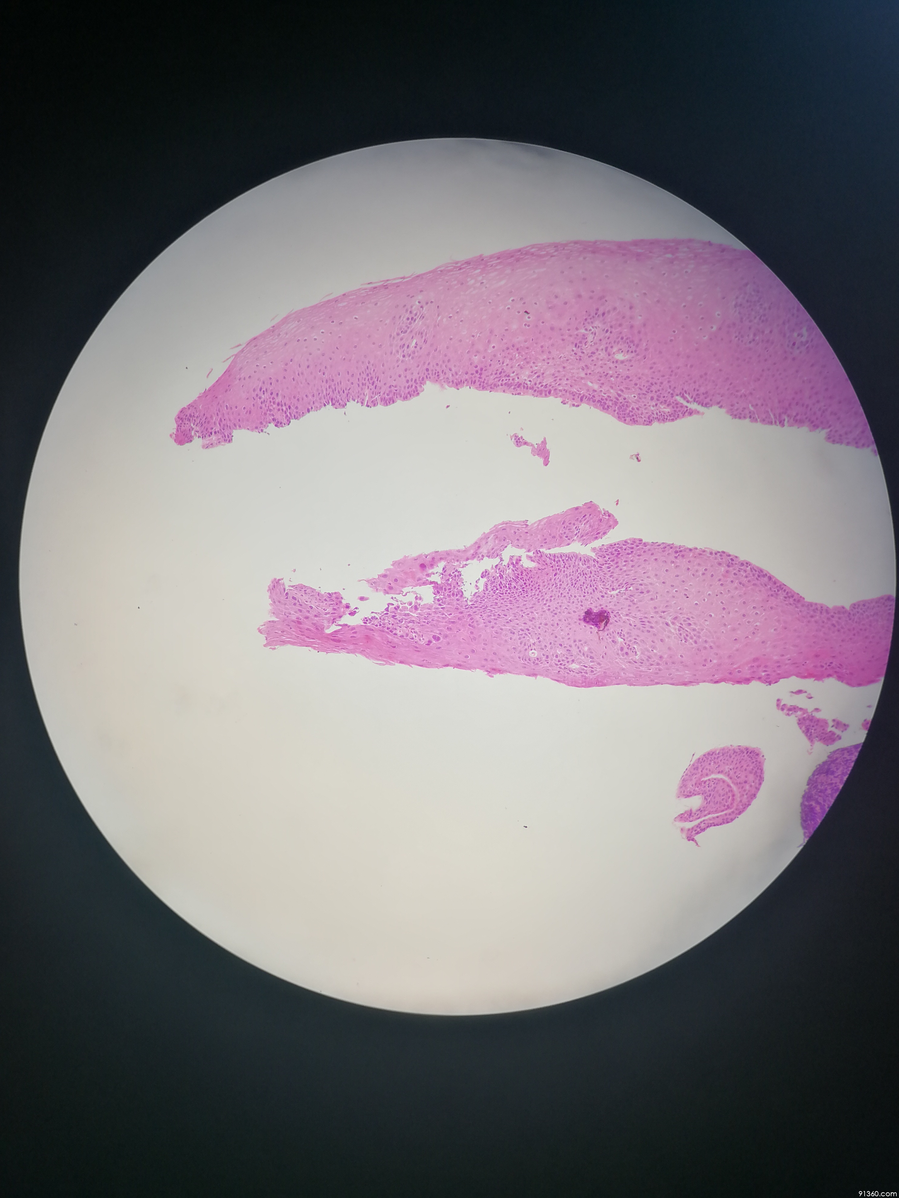 食管内皮细胞图片图片