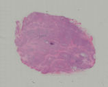 small-slice