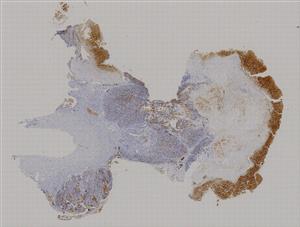 small-slice