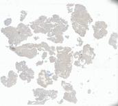 small-slice