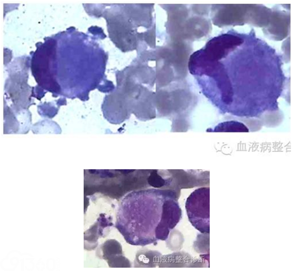 巨噬细胞与树突细胞形态学