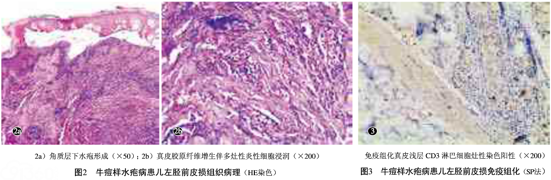 人患牛痘图片,牛身上的牛痘图片,牛痘图片(第2页)_大山谷图库