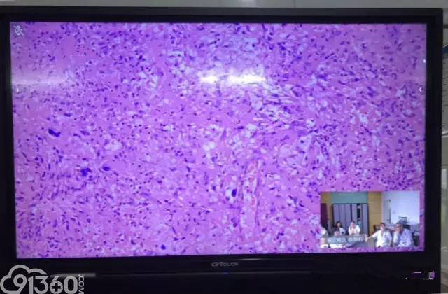 一场别具一格的病理远程会诊活动