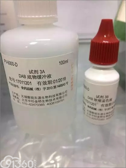 免疫组织化学染色