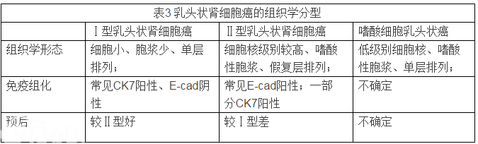 乳头状肾细胞癌的组织学分型