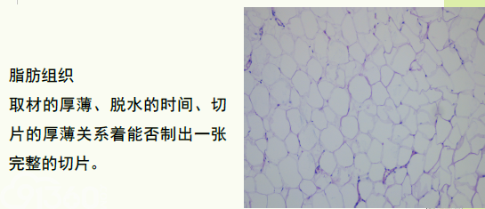 常规病理学技术流程及质控