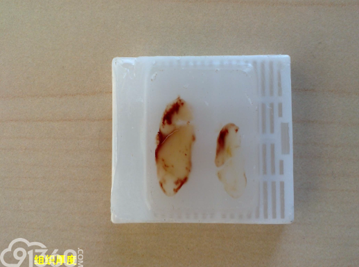 常规病理学技术流程及质控