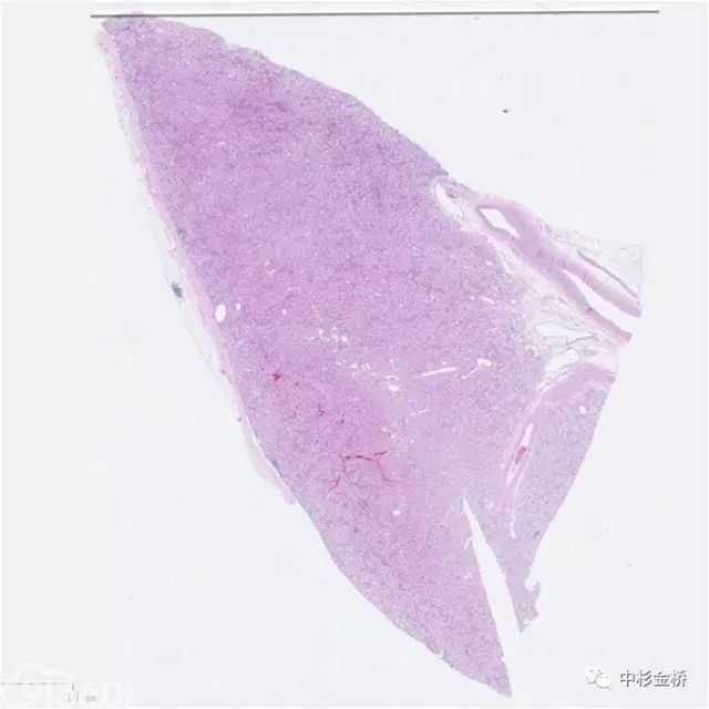 病理技术 你将如何迎接人工智能时代的到来?
