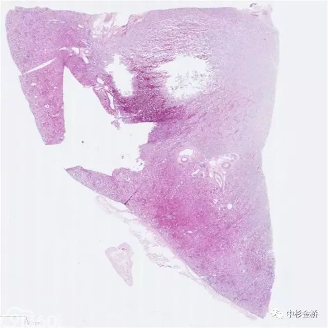 病理技术 你将如何迎接人工智能时代的到来?