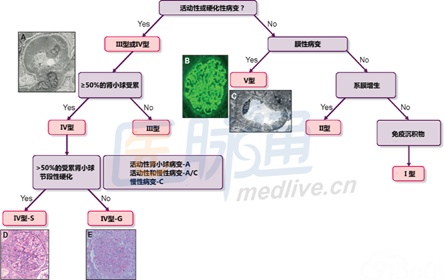 腎炎 治療