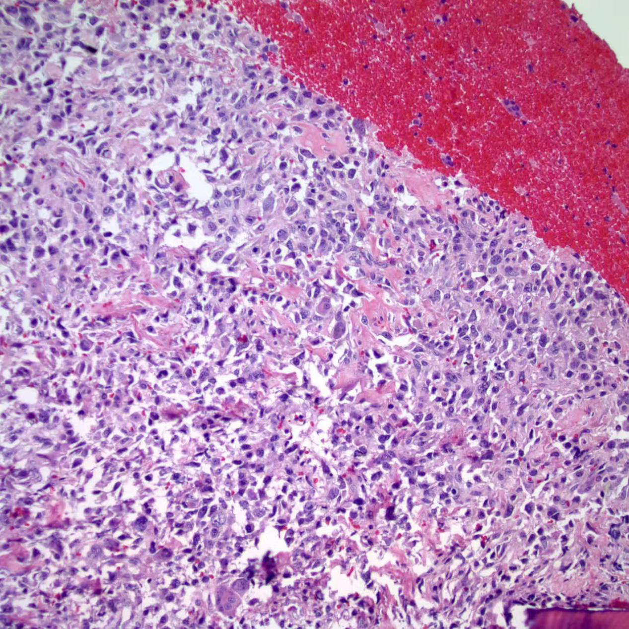 孔祥田教授朋友圈日常病例分享(11)