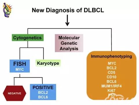 图文解析弥漫大B细胞淋巴瘤(DLBCL)