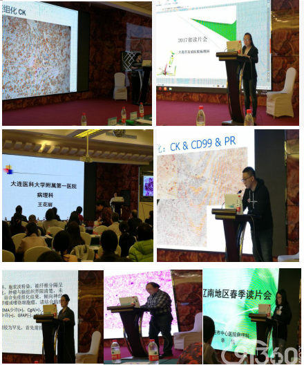 细胞病理专科基层培训巡讲2018辽宁省抗癌协会临床细胞学大连论坛暨辽南地区春季病理学读片会成功举办