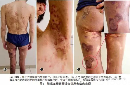 皮肤科情况