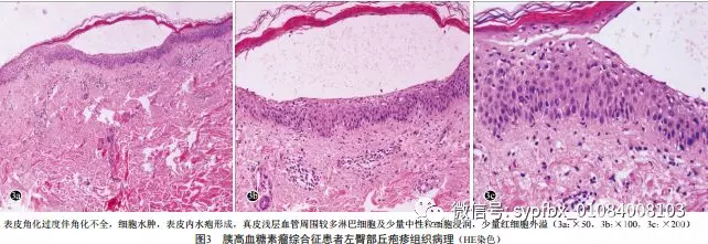 组织病理