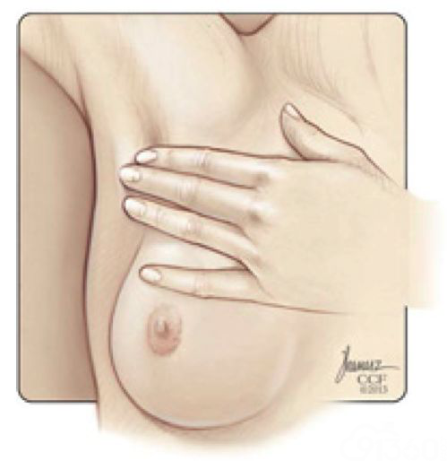 女子必修课:乳房自检的正确姿势