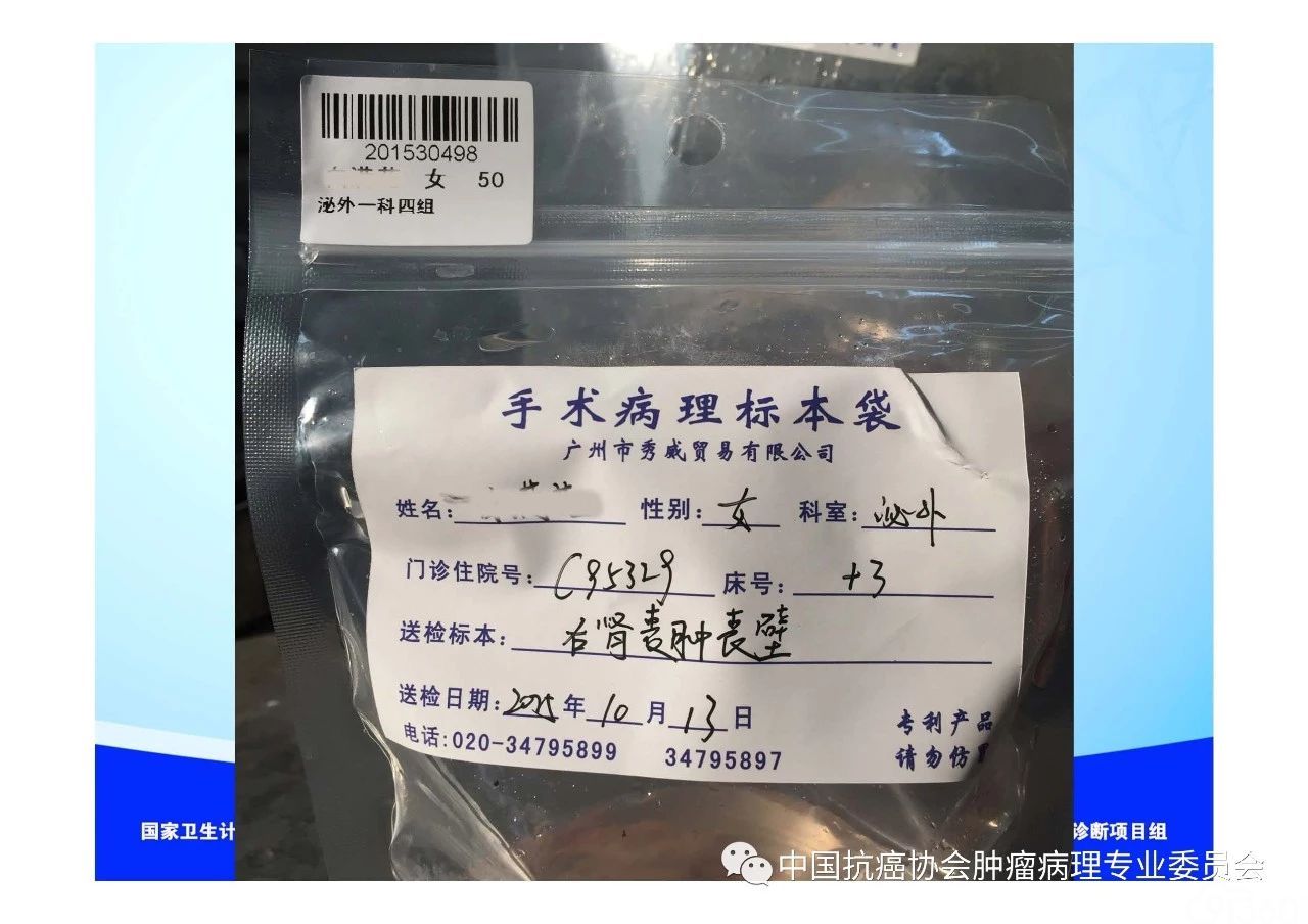 肿瘤病理规范化诊断标准 第1部分:总则