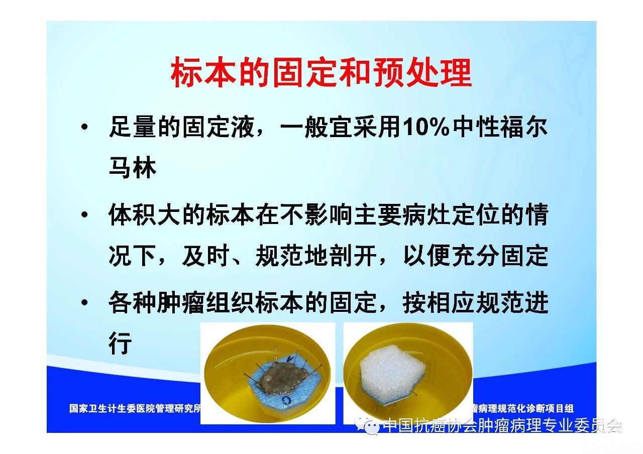 肿瘤病理规范化诊断标准 第1部分:总则