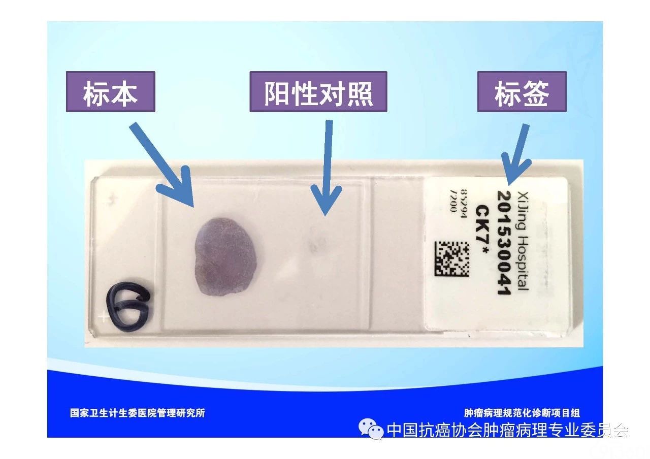 肿瘤病理规范化诊断标准 第1部分:总则