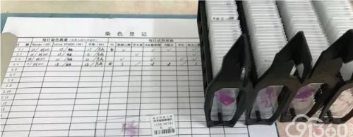 血淋淋的病理技术室?围观病理切片诞生全过程