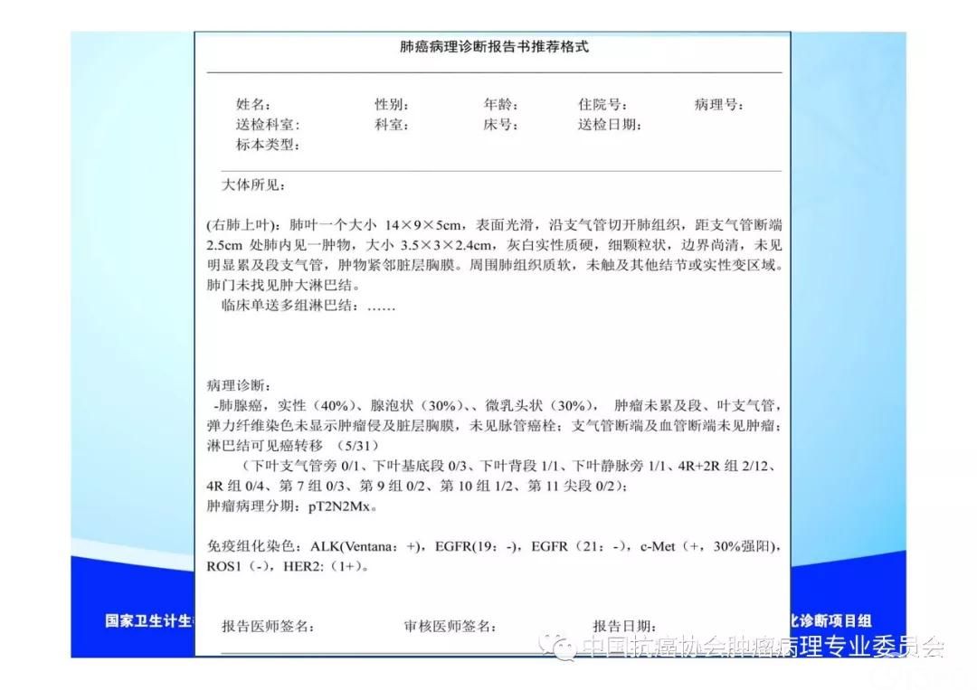 肿瘤病理规范化诊断标准 第3部分:肺癌病理诊断标准