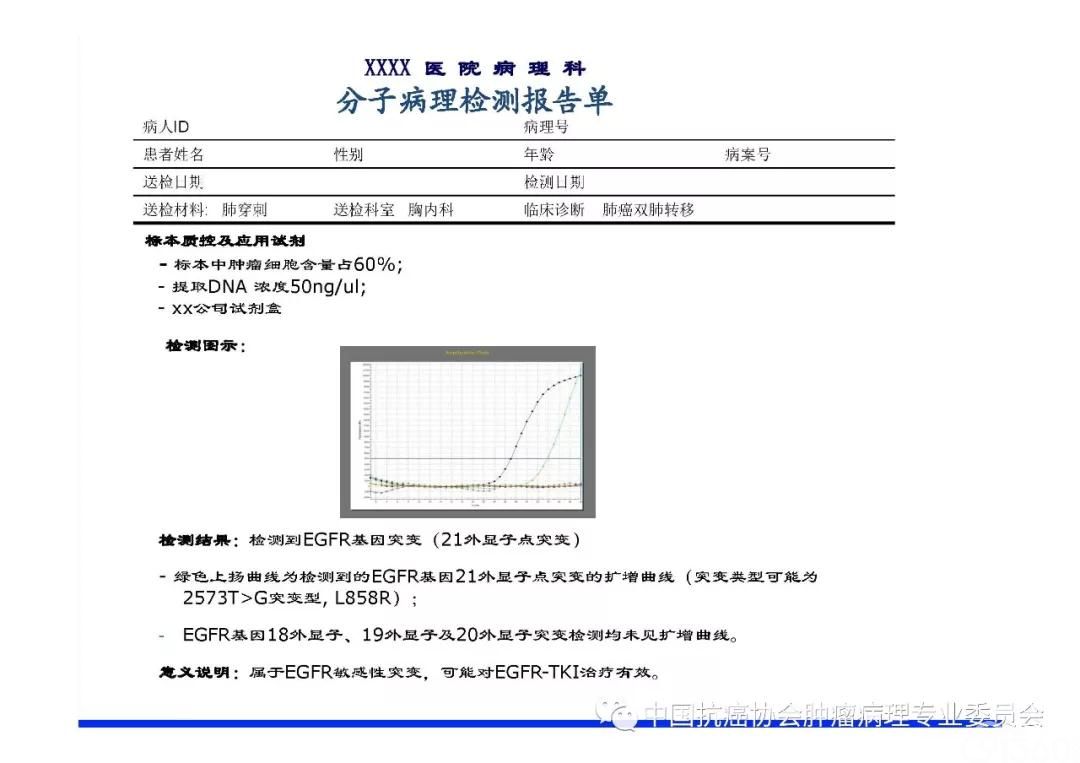 肿瘤病理规范化诊断标准 第3部分:肺癌病理诊断标准