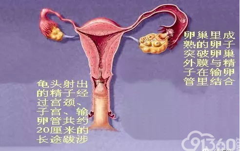 精子与卵子结合后再移师子宫腔内着床