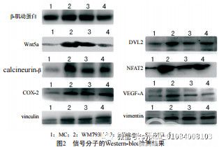 Wnt5a-Ca2+-CN-NFAT通路信号分子在黑素瘤中的表达