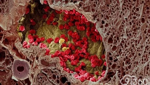 【综述】肿瘤发病机制:从肿瘤微环境到肠道微生物(上)