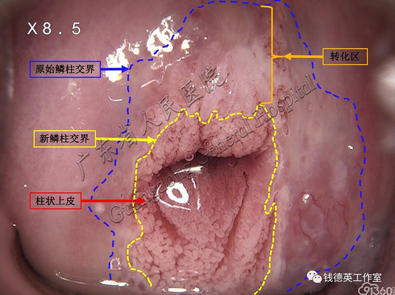肉眼所见