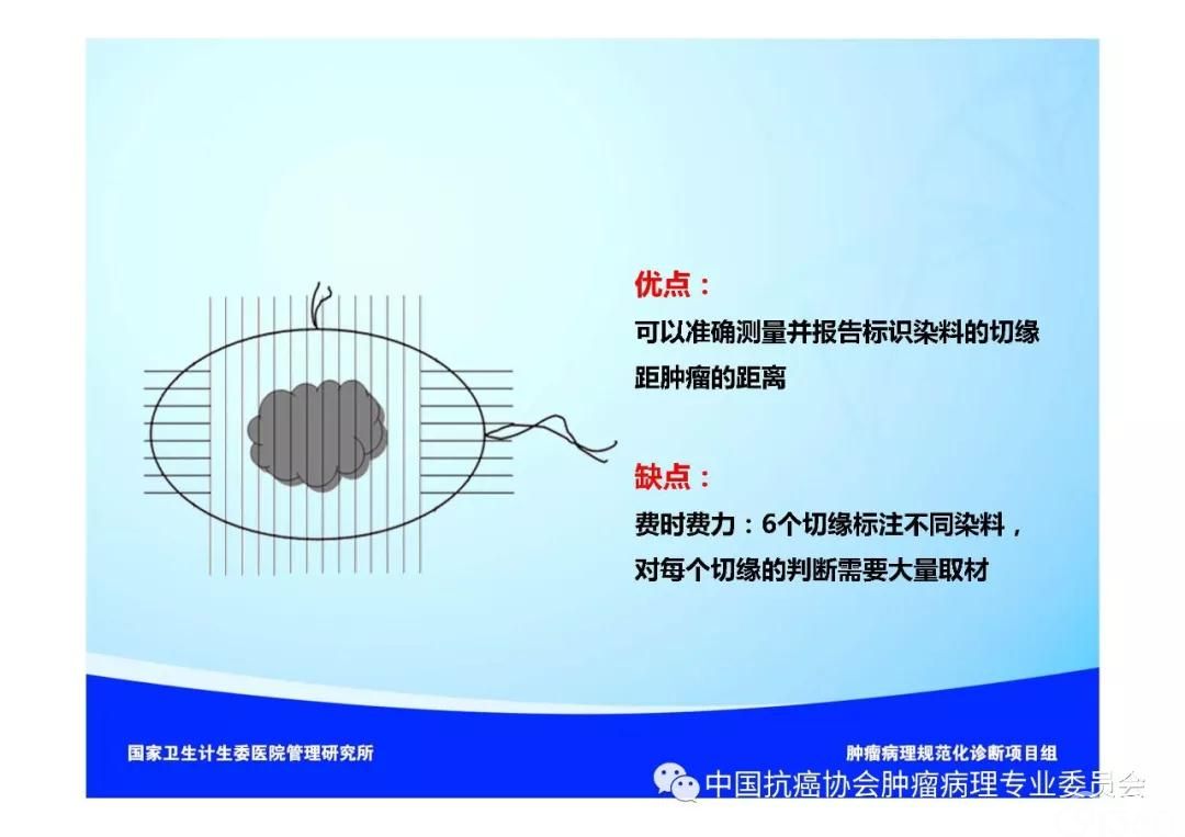 肿瘤病理规范化诊断标准 第5部分:乳腺癌病理诊断标准