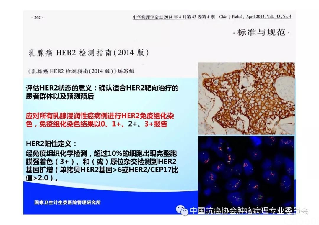 肿瘤病理规范化诊断标准 第5部分:乳腺癌病理诊断标准