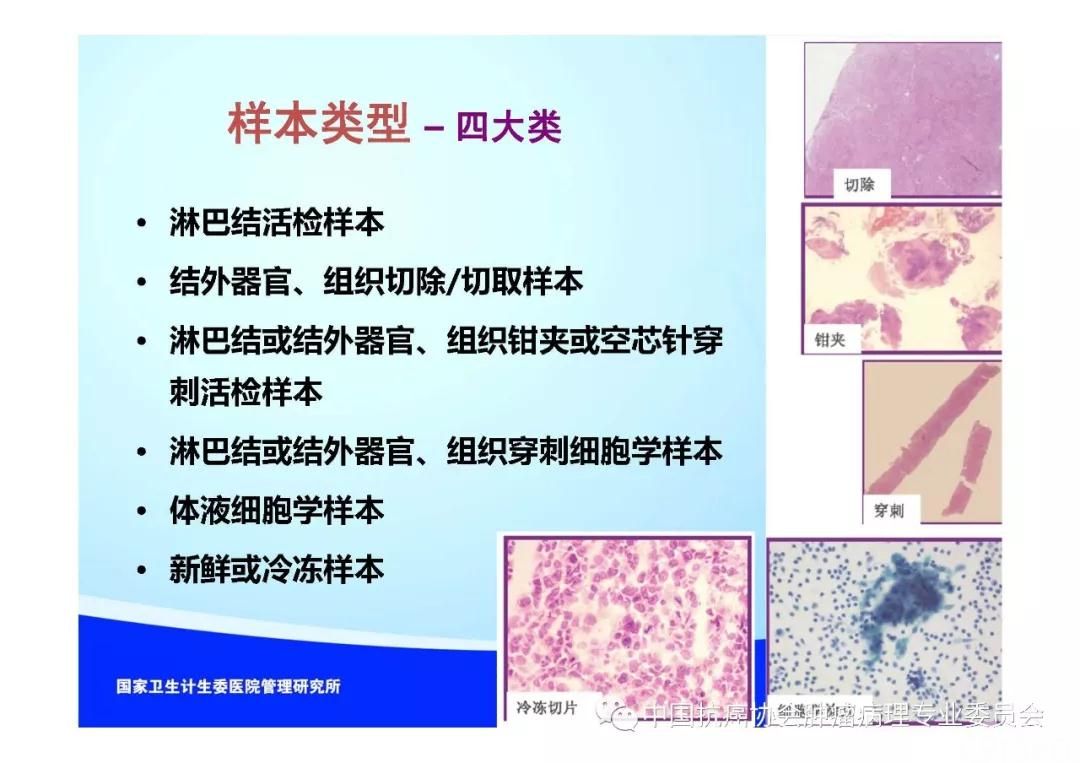 肿瘤病理规范化诊断标准 第2部分:淋巴组织肿瘤病理诊断标准