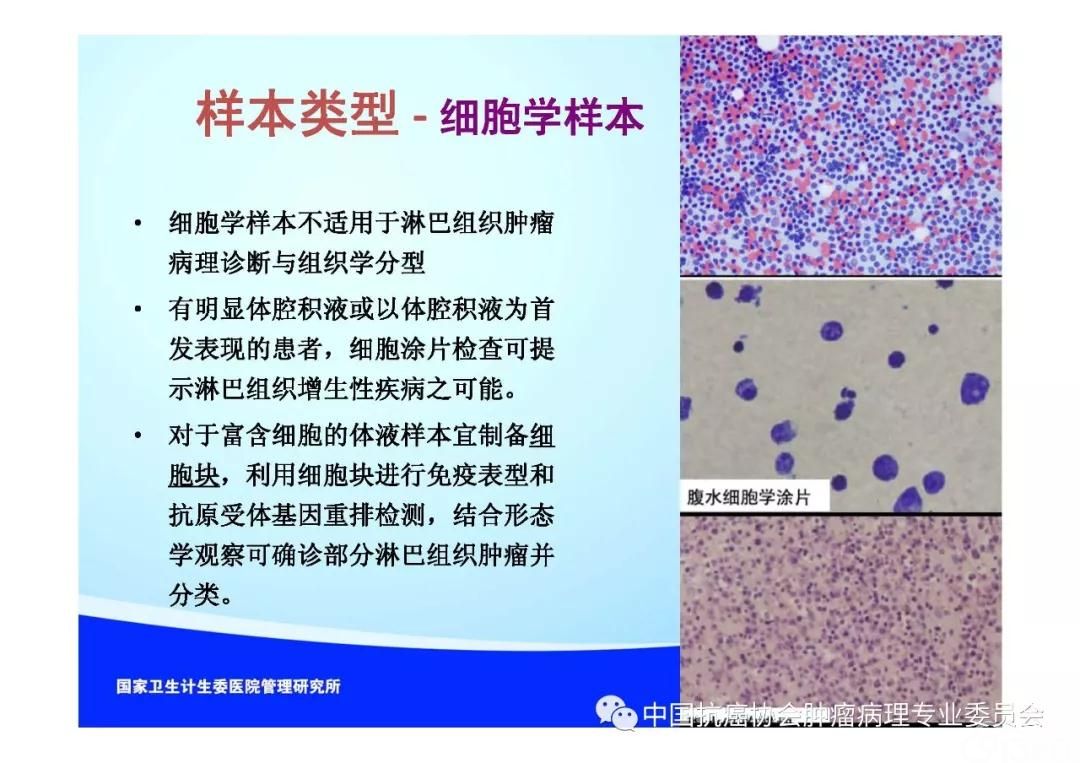 肿瘤病理规范化诊断标准 第2部分:淋巴组织肿瘤病理诊断标准